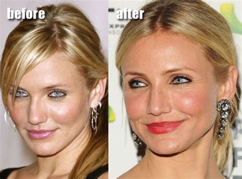 Cameron Diaz Plastic Surgery Before After Breast Implants