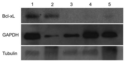 Western Blot Analysis Of Bcl Xl Expression In Human Normal And Tumoral