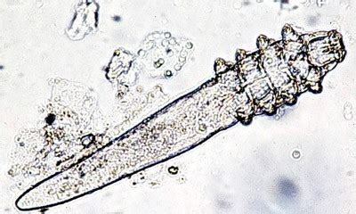 rosacea demodex mites microbes rosaceaorg