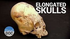Elongated Skulls. The Forerunners of the Inca | History - PlanetDoc Full Documentaries