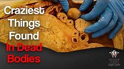 5 Craziest Things I've Found In Dead Bodies