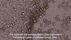 Balamuthia mandrillaris chows down on a plate of cultured human cells.