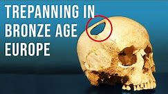 Are These Skulls Evidence of Bronze Age Brain Surgery?