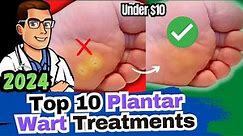 #1 BEST Plantar Wart Removal? [How To Get Rid of Warts Treatments]