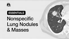 Nonspecific Lung Nodules & Masses | Chest Radiology Essentials