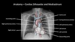 How to Interpret a Chest X-Ray (Lesson 2 - A Systematic Method and Anatomy)