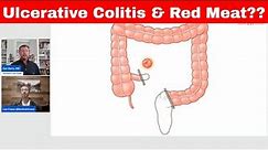 Ulcerative Colitis & Red Meat Warning @KENTCARNIVORE