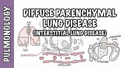 Interstitial Lung Disease (ILD) - Classification, pathophysiology, signs and symptoms