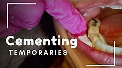 CEMENTING TEMPORARIES // PART 3 // Dental Assistant Tips