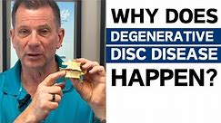 3 Most Common Causes Of Degenerative Disc Disease | Dr. John Zielonka Chiropractor in Ottawa