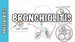 Bronchiolitis (causes, pathophysiology, signs and symptoms, treatment)