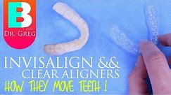 How Invisalign Works // How Clear Aligners Work
