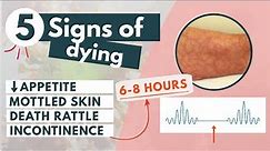 How to recognize a dying patient? | 5 signs of approaching death