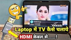 Laptop me tv kaise chalaye | How to connect set top box to laptop using HDMI cable | dd free dish
