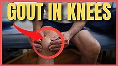 Is Your Knee Pain a Sign of Gout?