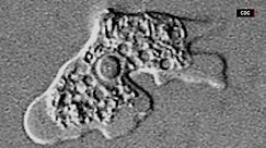 How rare are brain-eating amoebas?