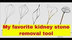 You Should Consider the Cook Kidney Stone Extractor or Dornier Venus for Ureteroscopy | Urology