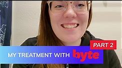 Byte Review! | PART 2 | Byte Clear Aligners Treatment Progress - Honest Review