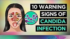 10 Symptoms of CANDIDA OVERGROWTH (Yeast Infection)