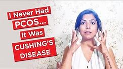I Never Had PCOS... It Was Cushing's Disease / Cushing's Syndrome #cushing