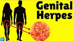 Herpes | Genital Herpes - Signs & Symptoms, Causes, Pathophysiology, Diagnosis, Treatment