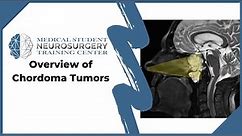 Overview of Chordoma Tumors