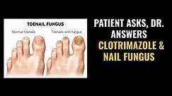 Is Clotrimazole The Best Treatment for Nail Fungus???