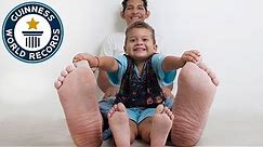 Jeison Rodriguez Hernandez: Largest feet in the world! - Guinness World Records