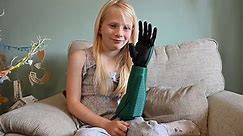 Seven-year-old girl becomes youngest Brit be fitted with bionic arm