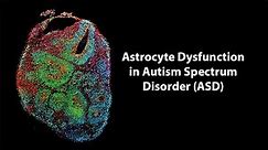 Astrocyte Dysfunction in Autism Spectrum Disorder (ASD) - Breaking News in Stem Cells