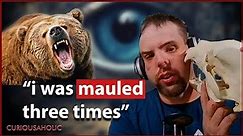 The Worst Bear Attack You Will Ever Hear About