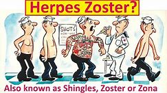 What is Herpes Zoster?