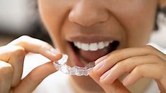Byte Nighttime Aligners: Reviews of Cost and Treatment - Dentaly.org
