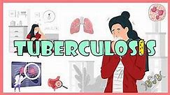 Tuberculosis(Overview):- Causes, Risk Factors, Pathogenesis, Signs & Symptoms , Diagnosis, Treatment