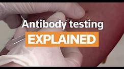 Explained- What are coronavirus antibody tests-