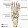 Accessory Bones of Foot