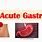 Acute Gastritis