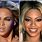 Beyonce Surgery