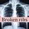 Broken or Bruised Ribs
