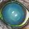 Canine Indolent Corneal Ulcer