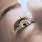 Eye Drops for Cataract Surgery