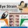 Eye Strain Treatment