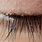 Eyebrow Lice