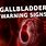 Gallbladder Problems Symptoms