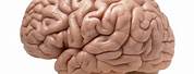 How Big Is a Human Brain