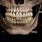 Human Skull with Teeth