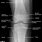 Normal Knee X-ray Anatomy