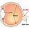 Optic Nerve Blind Spot