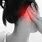 Pain Behind Ear Back of Head
