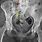 Sacrum Fracture X-ray